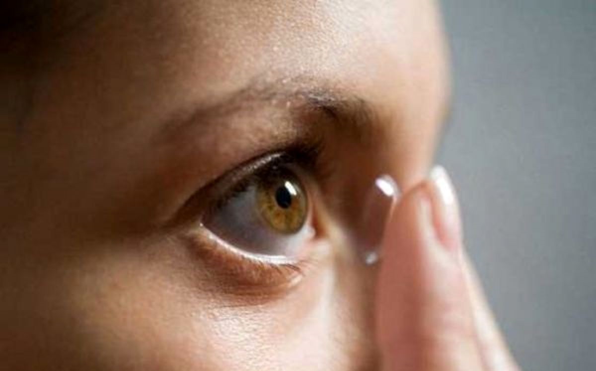 لنز تماسی - عوارض استفاده از لنز طبی