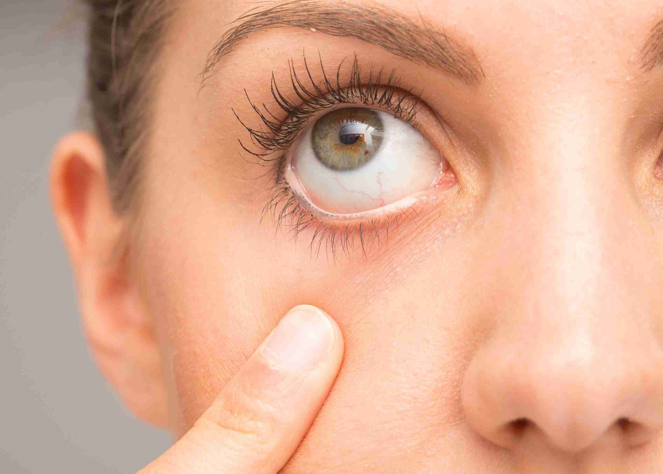 عوارض خشکی چشم چیست