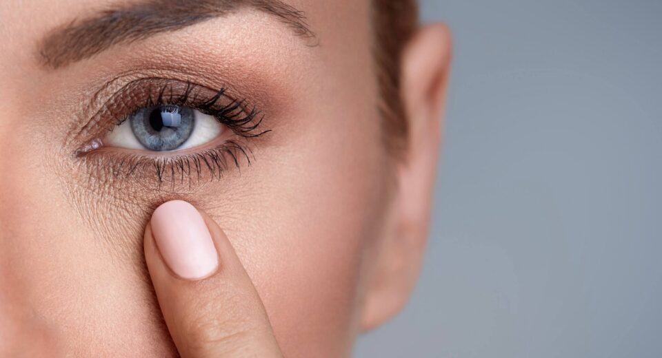 درمان گودی زیر چشم - قوز بینی